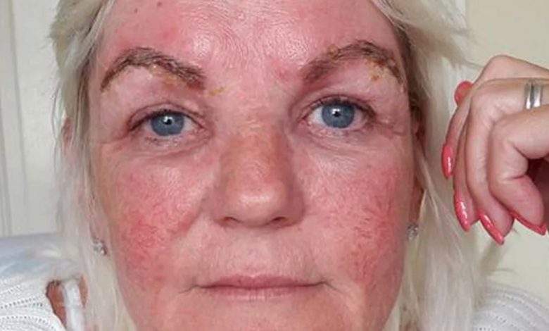 JANE È ANDATA AL SALONE PER FARE DEI TRATTAMENTI CHE SONO FINITI IN DISASTRO. IL SUO VISO SI È GONFIATO E LE SUE SOPRACCIGLIA SONO RIMASTE COME “DUE LUMACHE NERE” JANE È ANDATA AL SALONE PER FARE DEI TRATTAMENTI CHE SONO FINITI IN DISASTRO. IL SUO VISO SI È GONFIATO E LE SUE SOPRACCIGLIA SONO RIMASTE COME “DUE LUMACHE NERE”